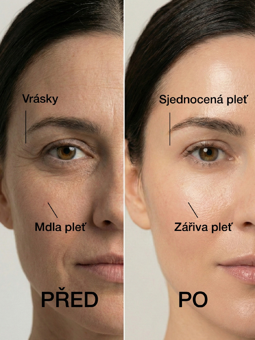 Bakuchiol olejové sérum – před a po