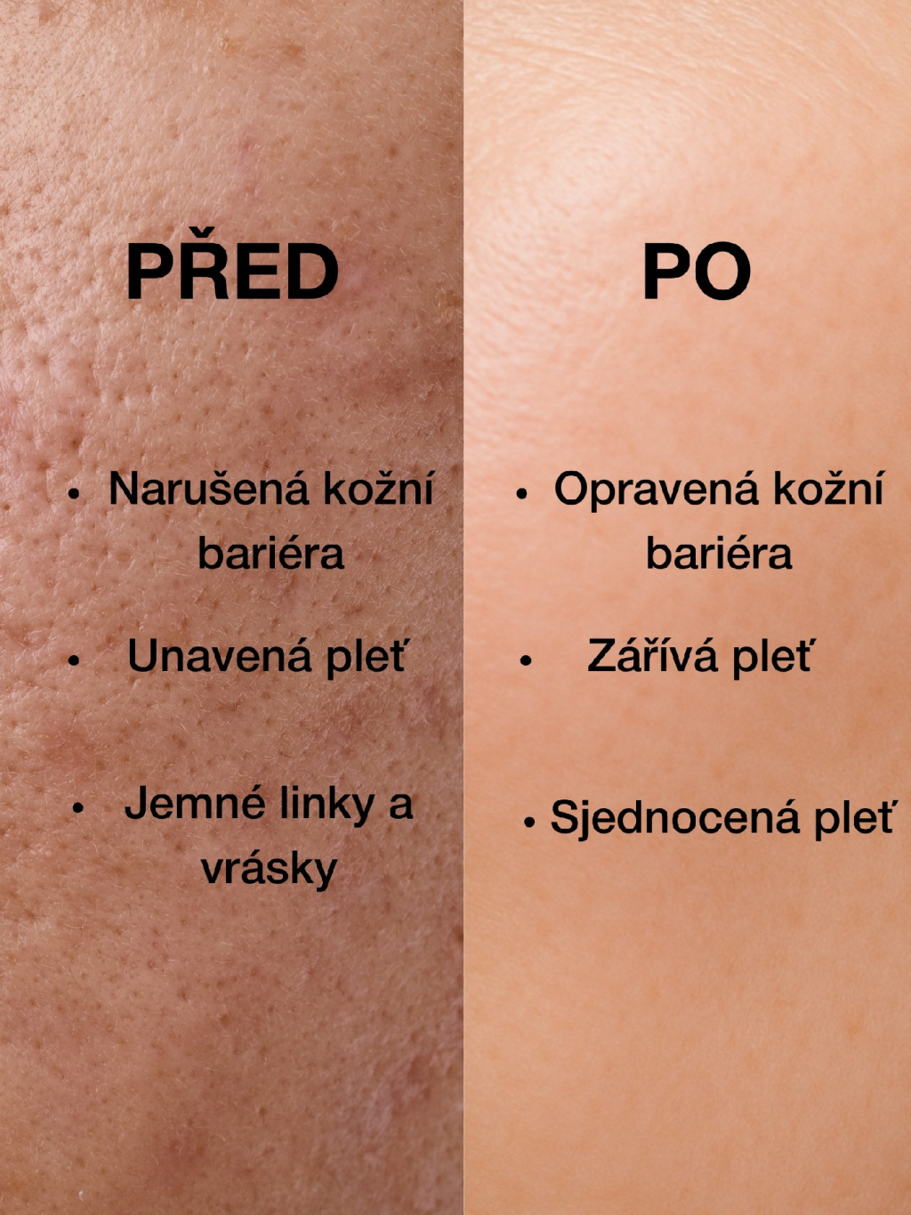 Collagen Boost Serum – před a po