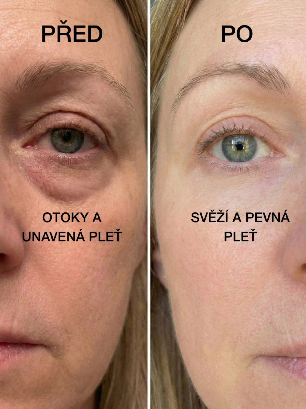 Caffeine Gel Booster – před a po